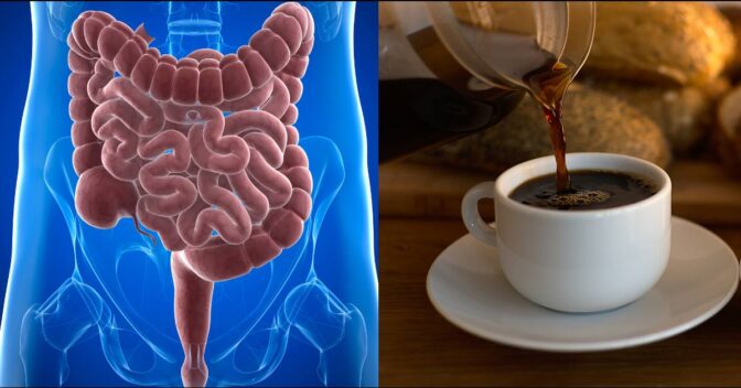 Dicas e Alimentação: CAFÉ e INTESTINO: Benefícios, Efeitos e Cuidados Especiais